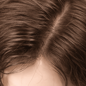 Wovana Hair โ Best Hair Wig & Patch 100% Human Hair Original