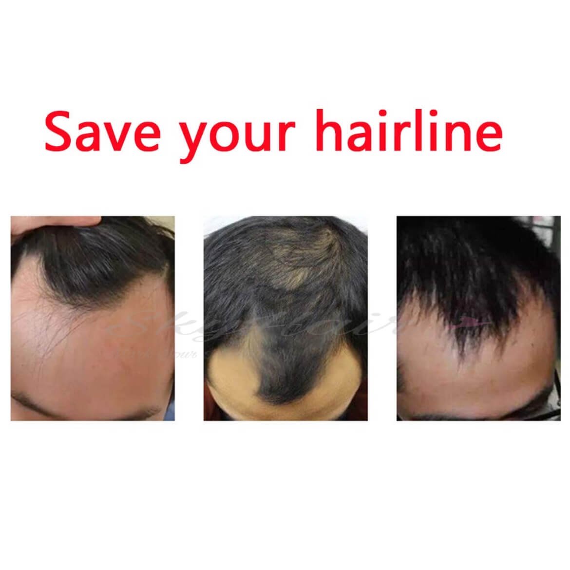 Frontal Hair Piece for Natural Front Hairline/ Receding Hairline - Image 3