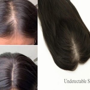 Wovana Hair — Best Hair Wig & Patch 100% Human Hair Original