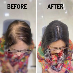 Wovana Hair — Best Hair Wig & Patch 100% Human Hair Original