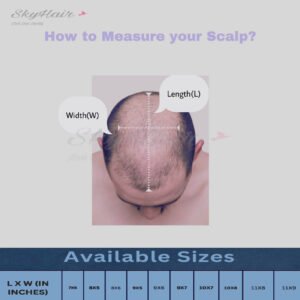 Wovana Hair โ Best Hair Wig & Patch 100% Human Hair Original