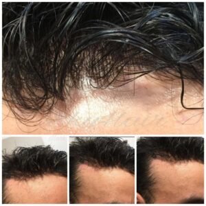 Wovana Hair โ Best Hair Wig & Patch 100% Human Hair Original