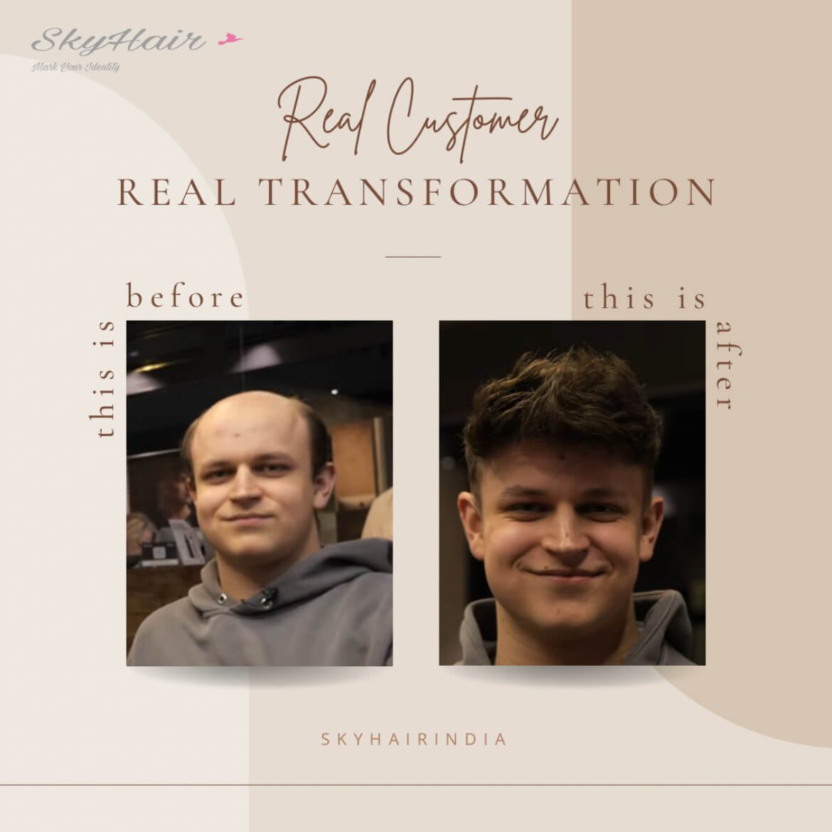 Fine R Mono Hair Patch - Image 3