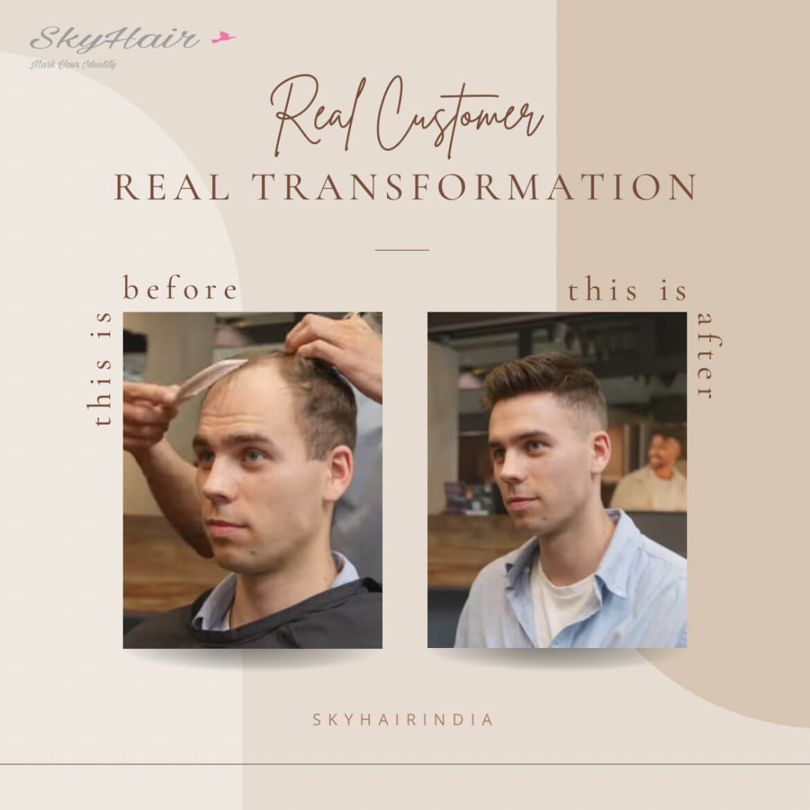 Golden Hair Mono Hair Patch (Premium Monofilament Series) - Image 3