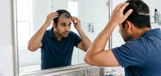 Man checking the position of a hair patch in a mirror before applying adhesive